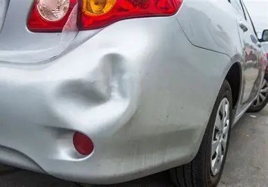 Dent removal